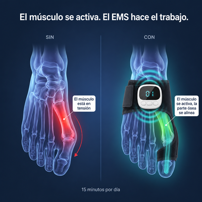 ems-sensacion