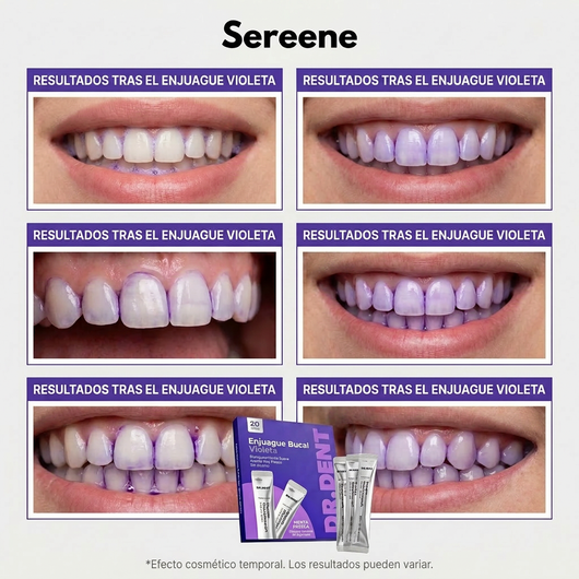 Enjuague Bucal Violeta Sereene™